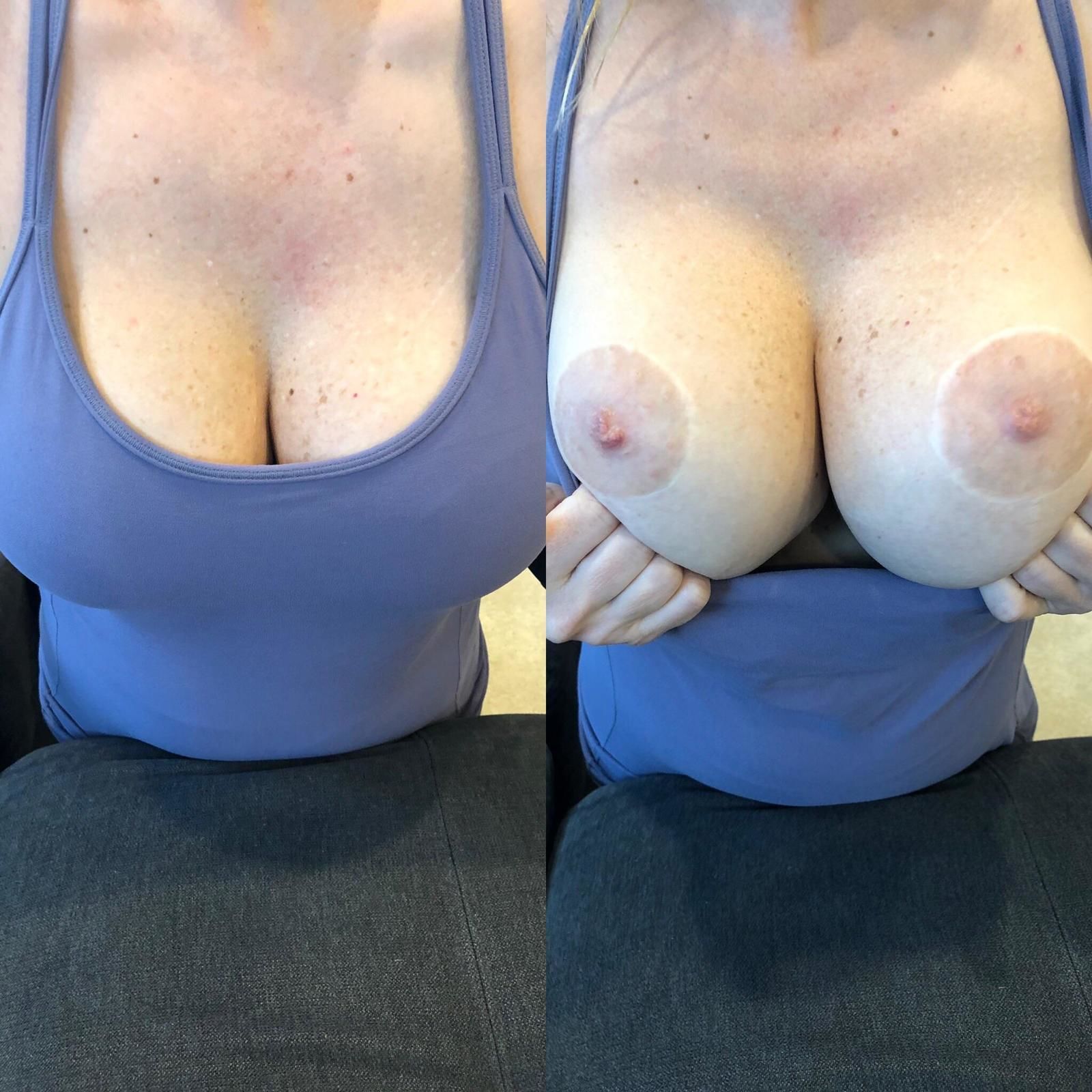 Showing My Wife's Large Breast